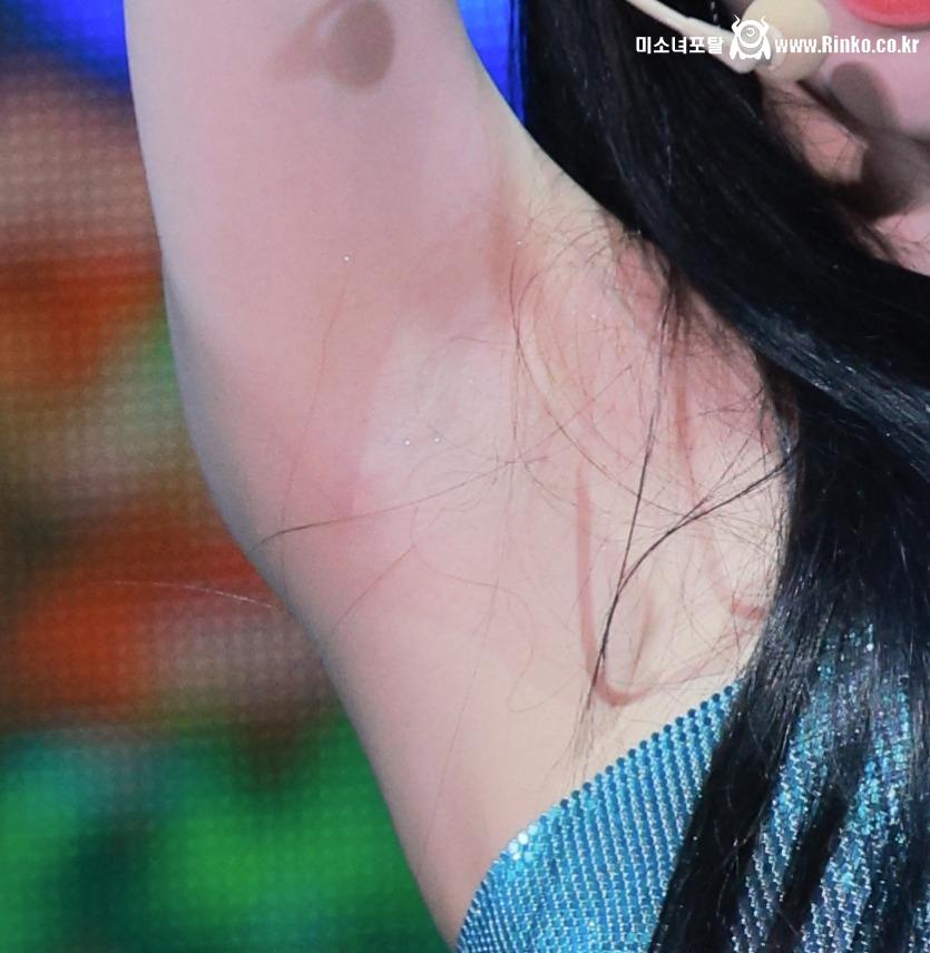 에스파 카리나 3단 확대 겨드랑이_112945_3.jpg