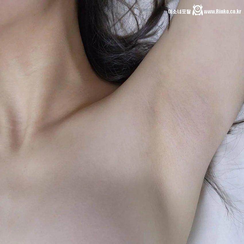겨드랑이 1티어_113363_1.jpg