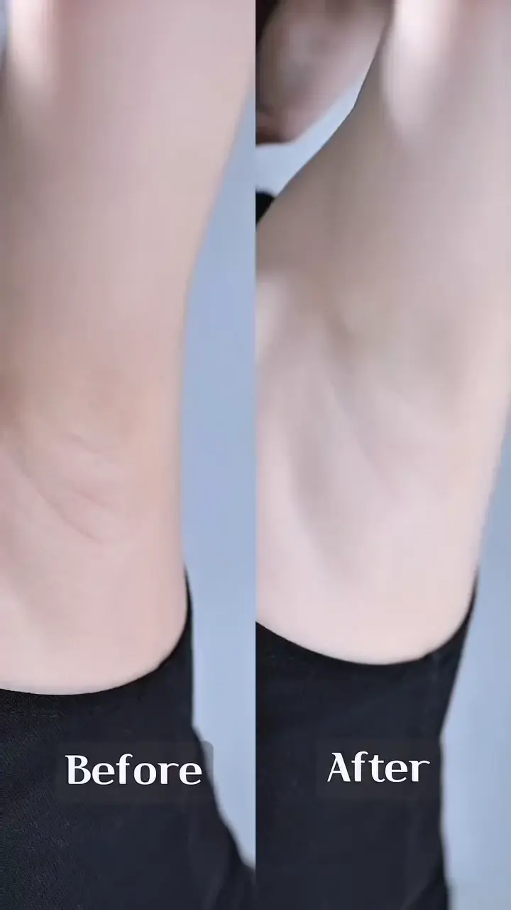 겨드랑이 착색 고민녀 한지나 겨드랑이_114892_3.webp