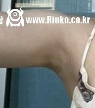 색이 다른 윈터의 양쪽겨_115116_3.jpeg