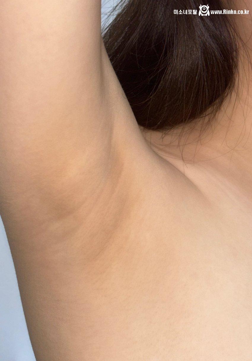 겨드랑이_116634_1.jpeg
