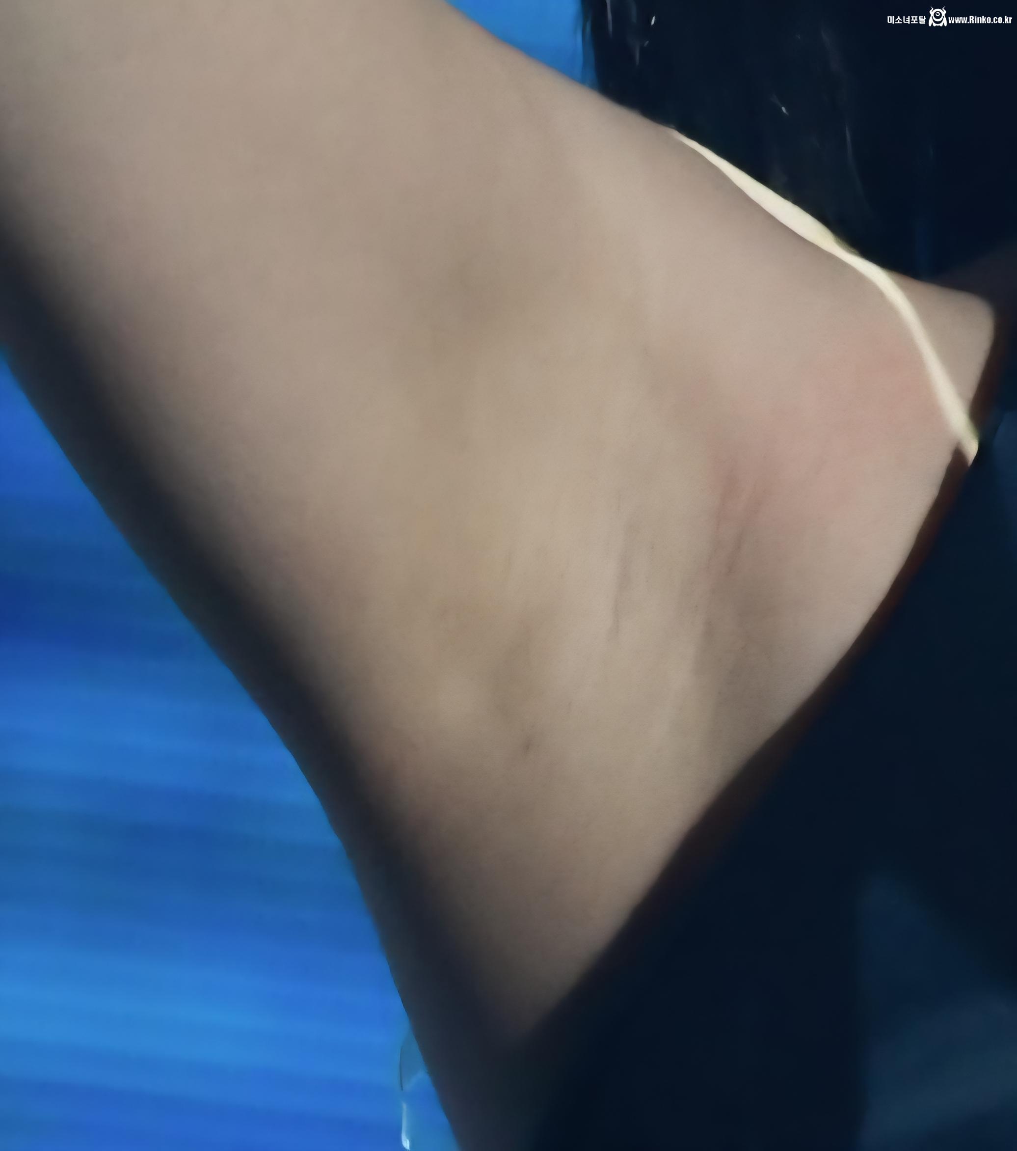 아이브 레이 3단 확대 겨드랑이_117013_1.jpg