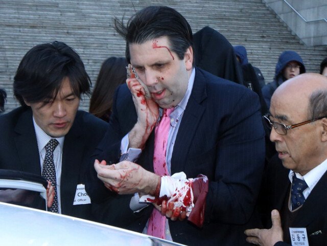 2.jpg 주한대사가 습격받았던 두 사건