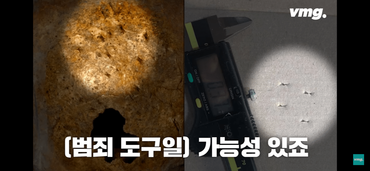 pic_011.png 요즘 화제인 개구리 소년 사건 흉기에 대한 서울대 법의학자의 입장