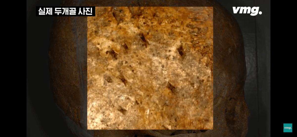 pic_003.png 요즘 화제인 개구리 소년 사건 흉기에 대한 서울대 법의학자의 입장