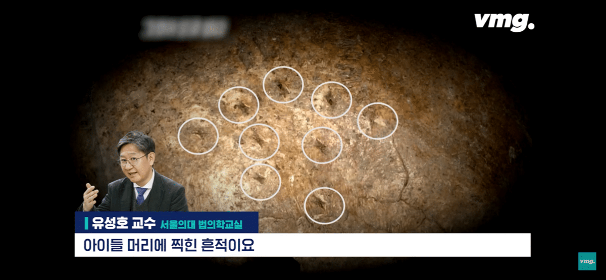 pic_005.png 요즘 화제인 개구리 소년 사건 흉기에 대한 서울대 법의학자의 입장