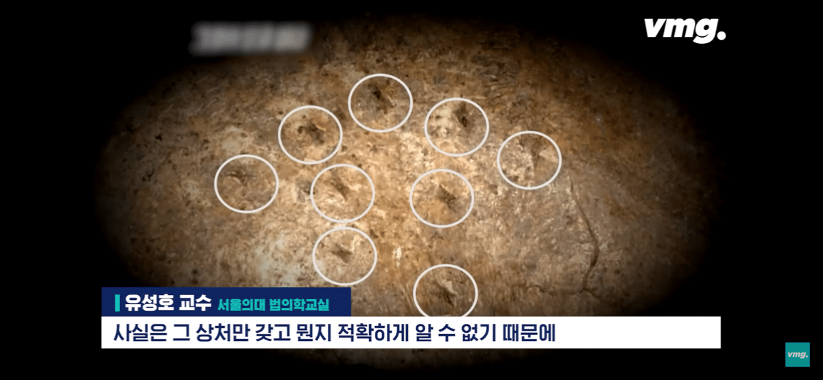 pic_006.png 요즘 화제인 개구리 소년 사건 흉기에 대한 서울대 법의학자의 입장