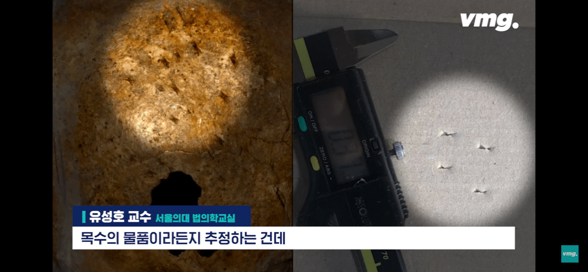 pic_007.png 요즘 화제인 개구리 소년 사건 흉기에 대한 서울대 법의학자의 입장