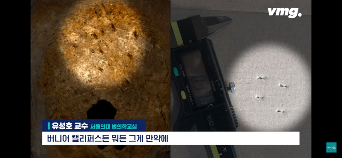 pic_008.png 요즘 화제인 개구리 소년 사건 흉기에 대한 서울대 법의학자의 입장