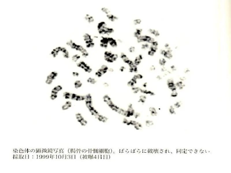 NOS0lb5sHhmF2PwgsvTWBPYTioHulvFFpbkVle8kWjveJKg1LPjP7PKeuT_SsLtucvO6fylYnEv-FF5KA9vRODDDWPLQb4AF5bpgBQXjW-87H9QGxYSVUWIfWlqrhhO8hUyTUEdRdyn6SfP7ZIvtJbdXT1TVmxUlCD70-N_K7kQ.webp.ren.jpg 약혐) 염색체가 산산조각나면 생기는 일