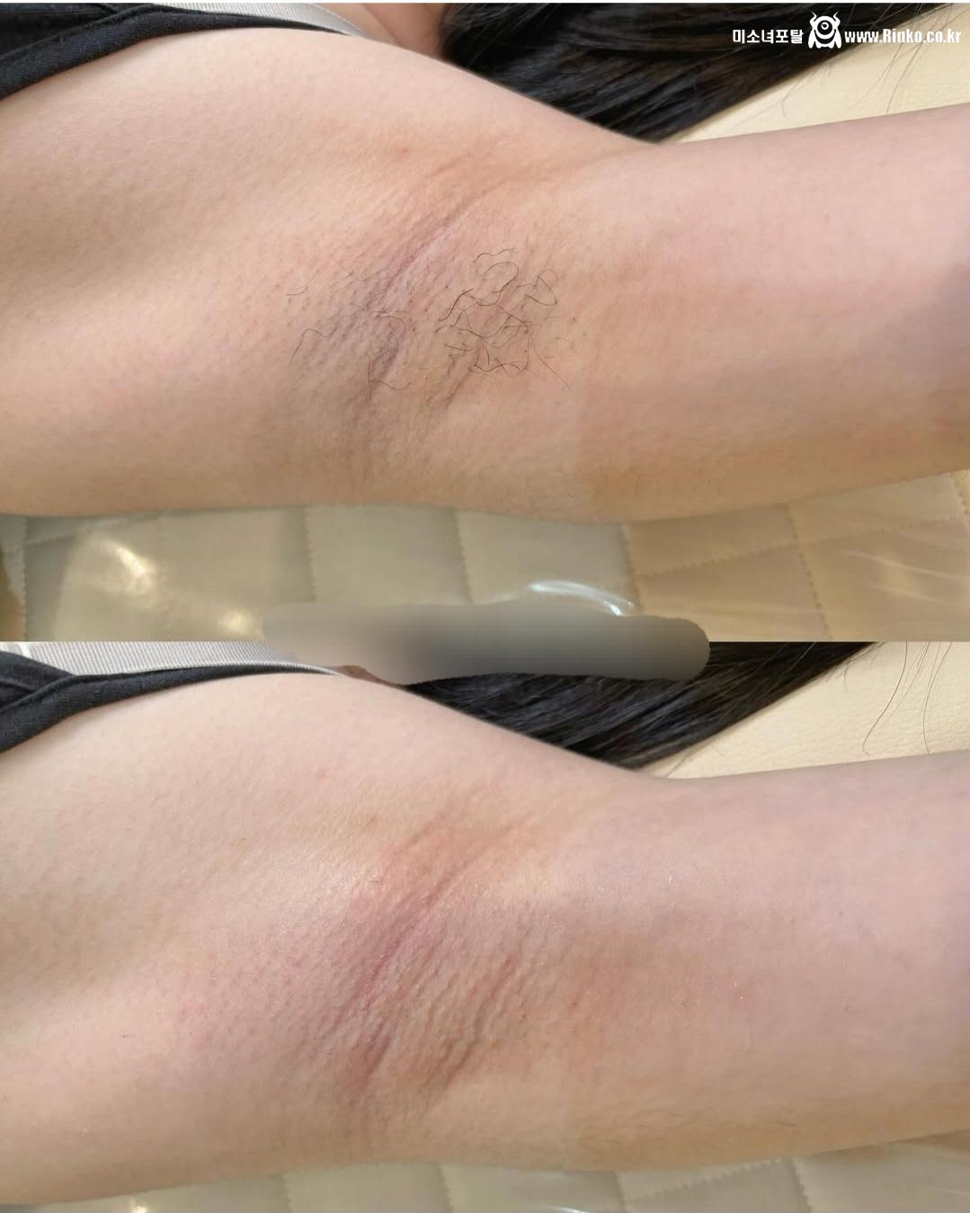 왁싱겨 모음_117190_10.jpg