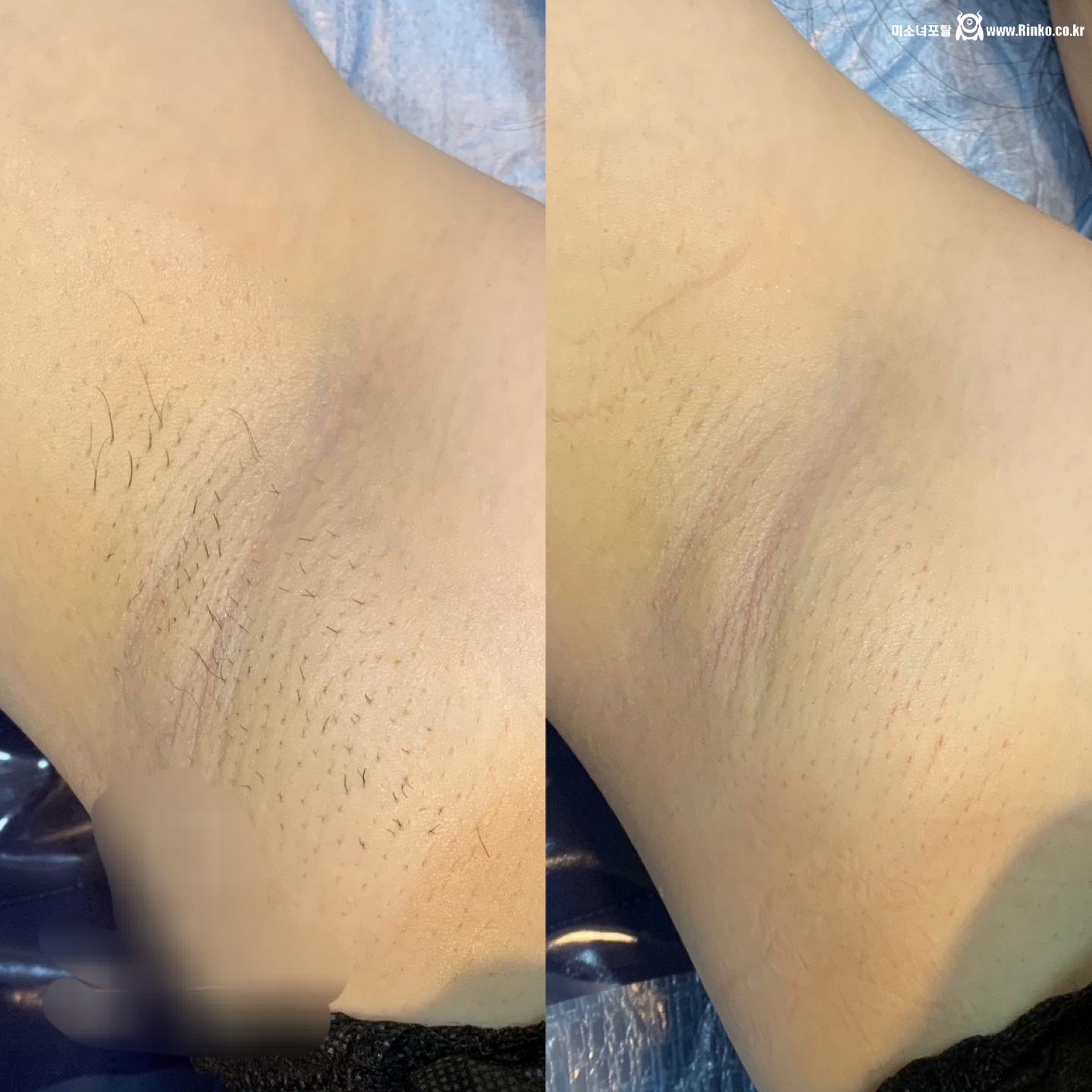 왁싱겨 모음_117190_12.jpg