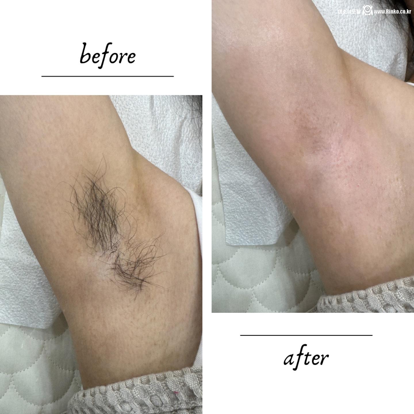 왁싱겨 모음_117190_18.jpeg