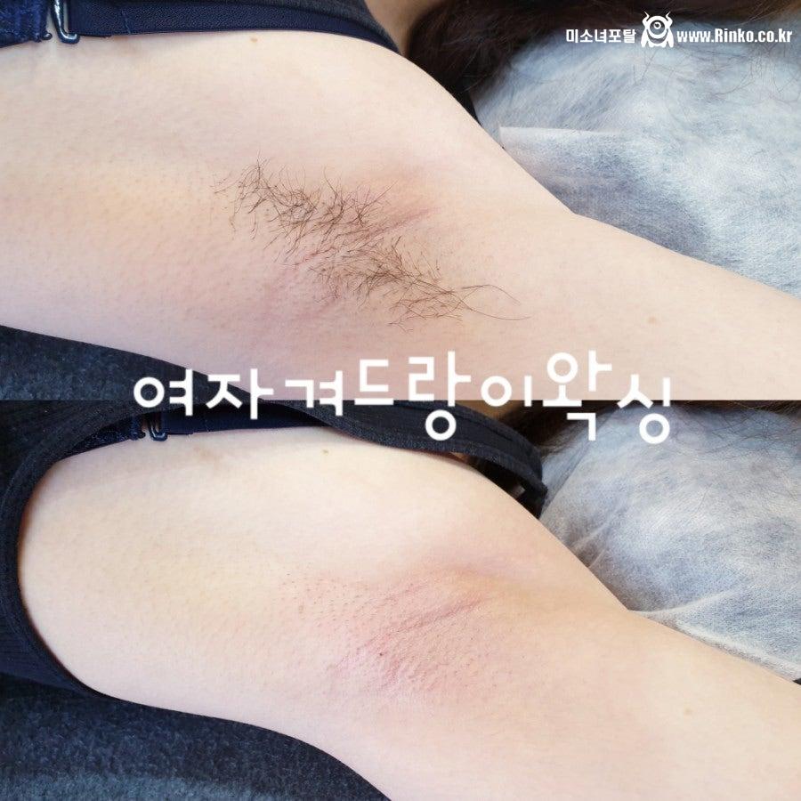 왁싱겨 모음_117190_2.jpg