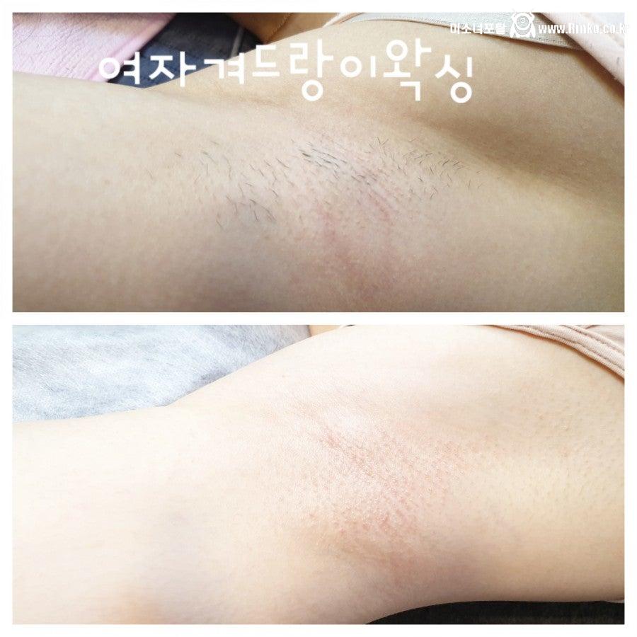 왁싱겨 모음_117190_3.jpg