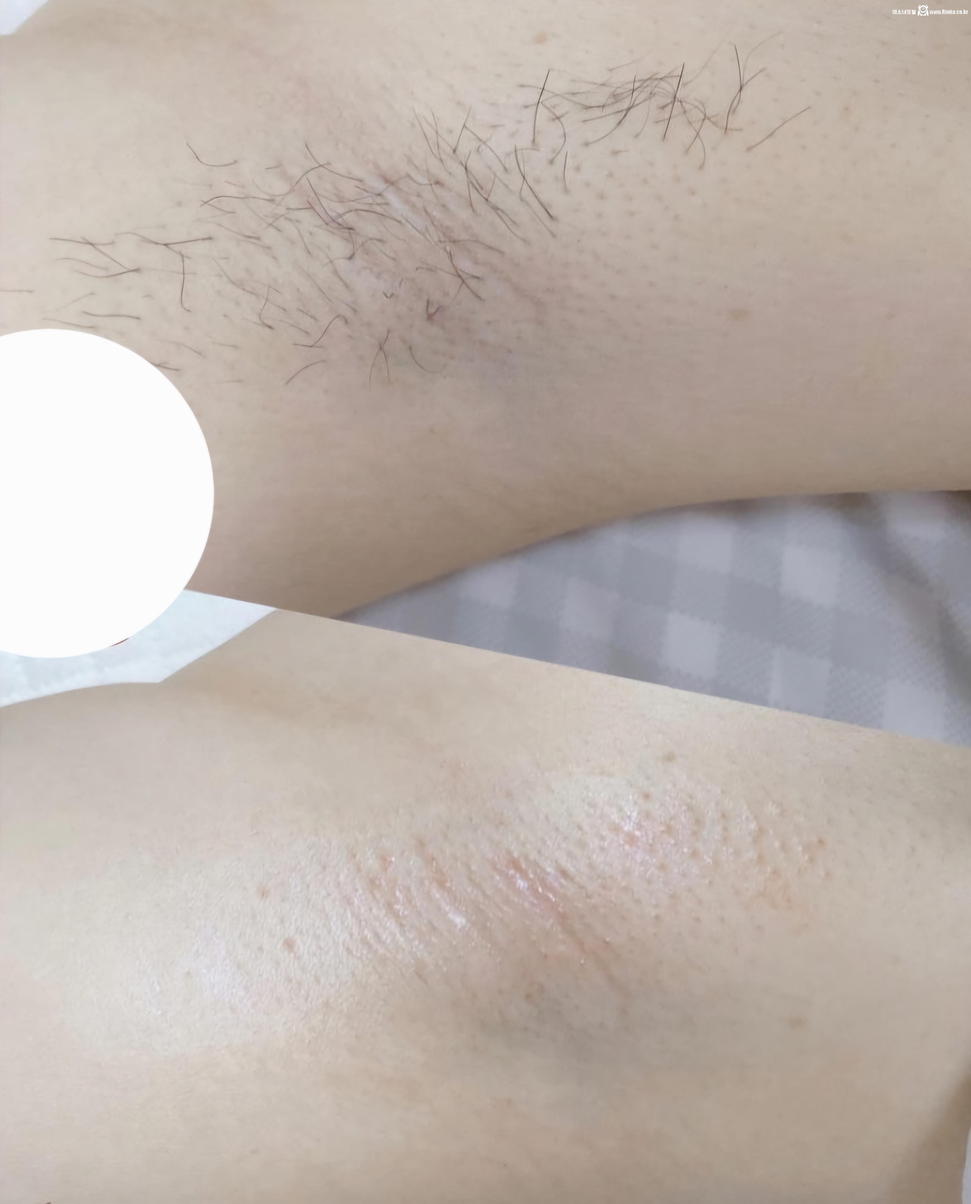 왁싱겨 모음_117190_5.jpg