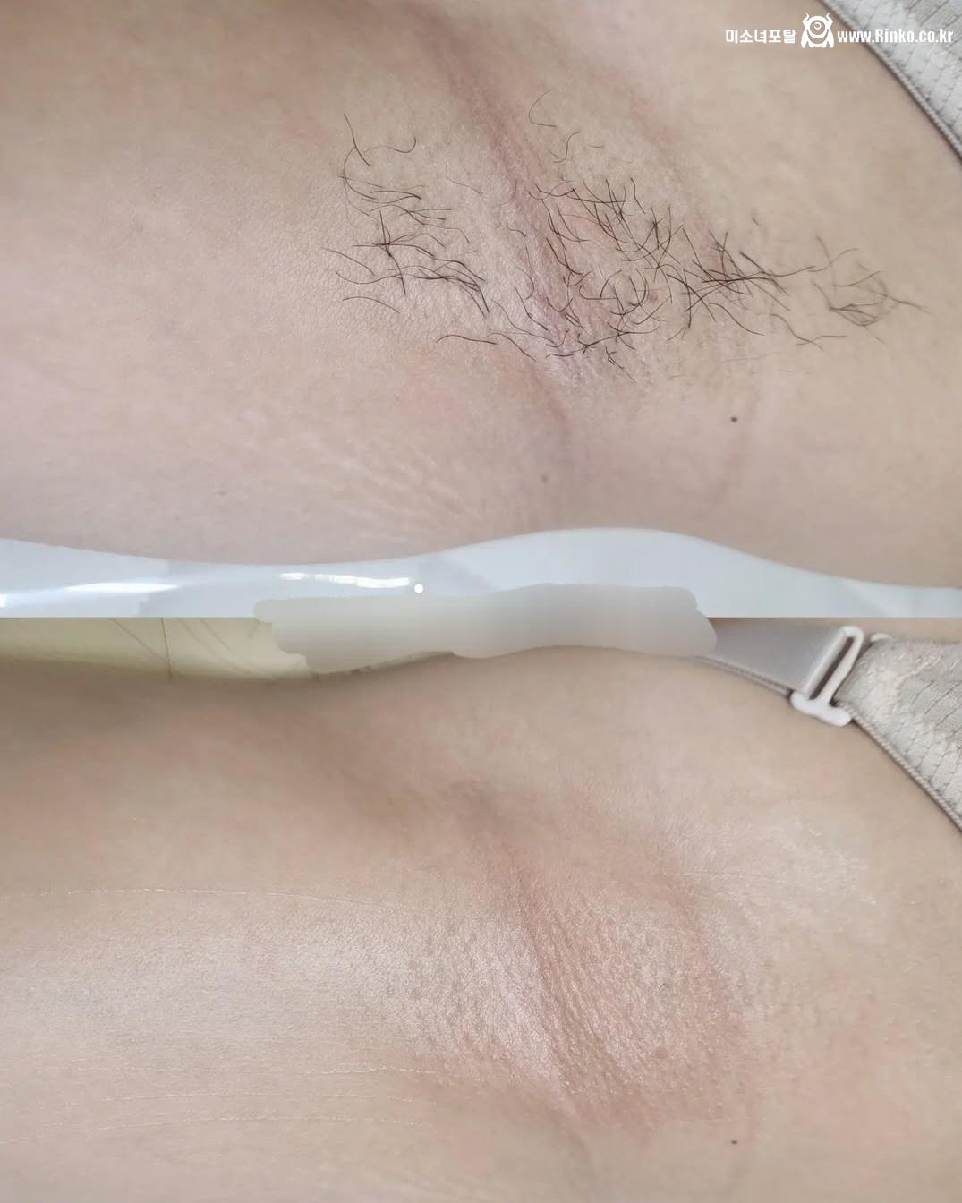 왁싱겨 모음_117190_6.jpg