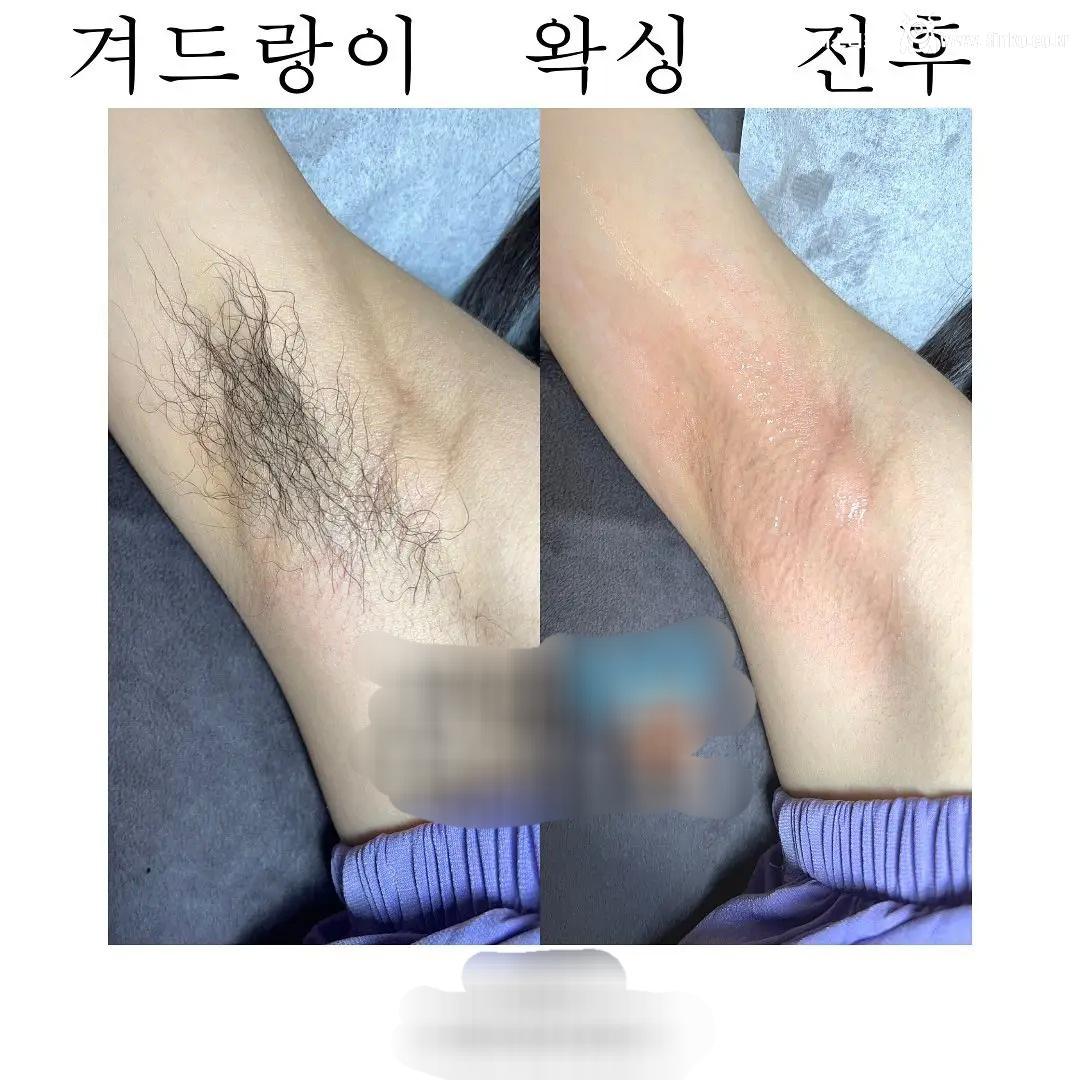 왁싱겨 모음_117190_13.jpg