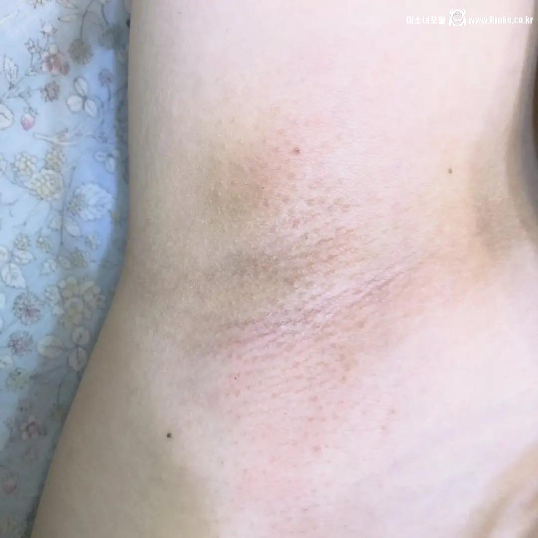 왁싱겨 모음_117190_14.jpg