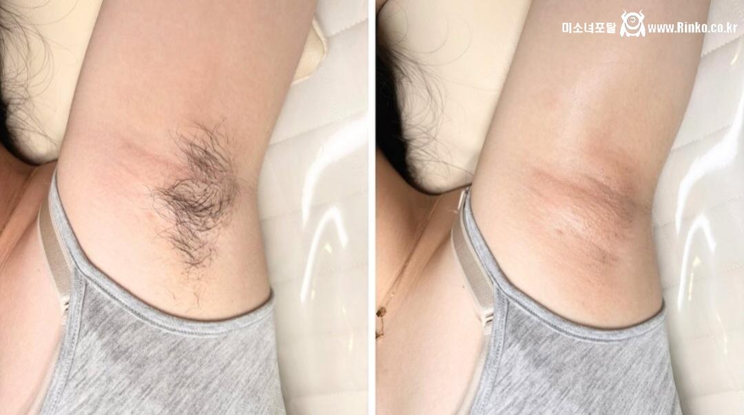 왁싱겨 모음_117190_8.jpg