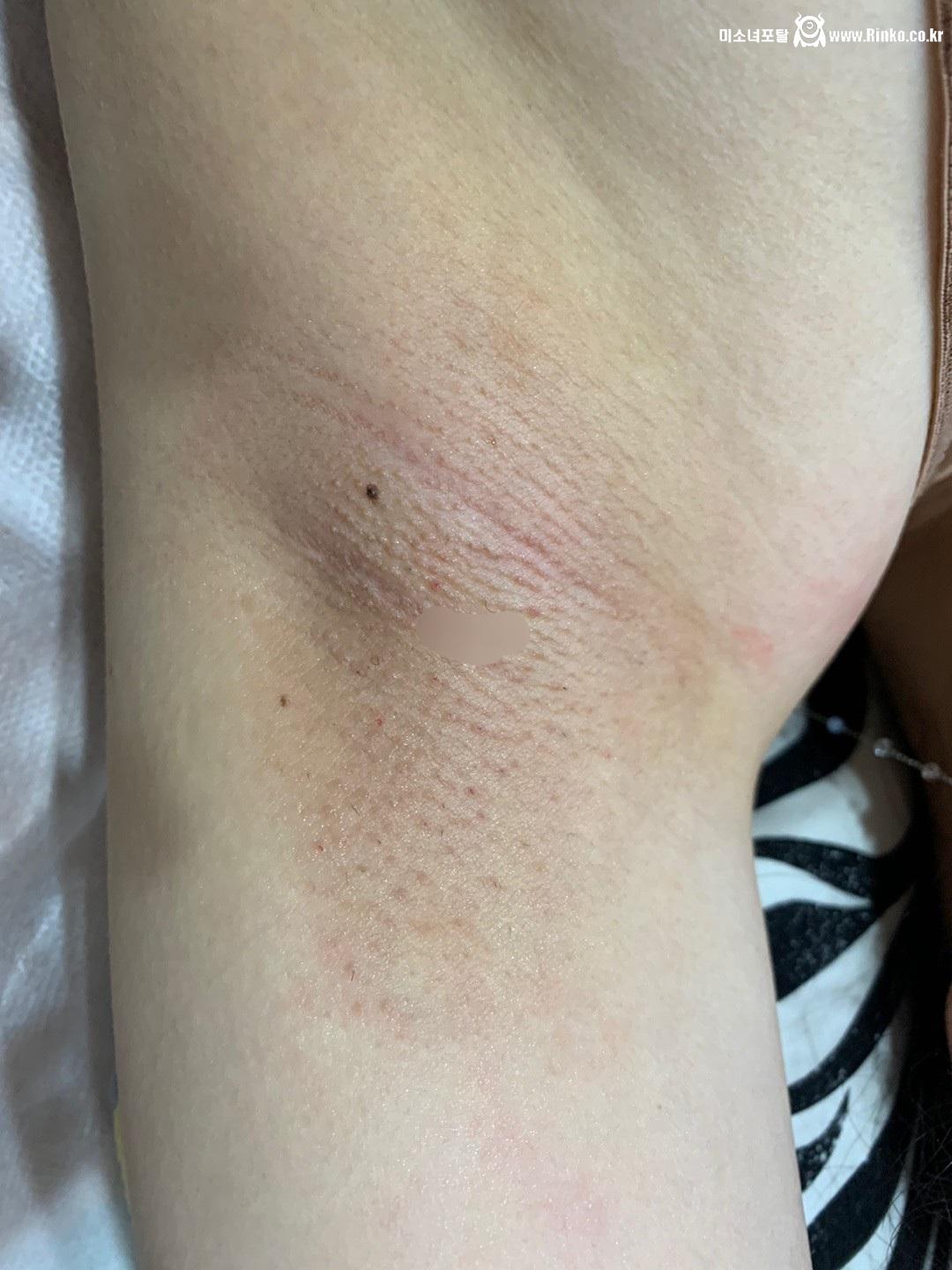 왁싱겨 모음_117190_9.jpg