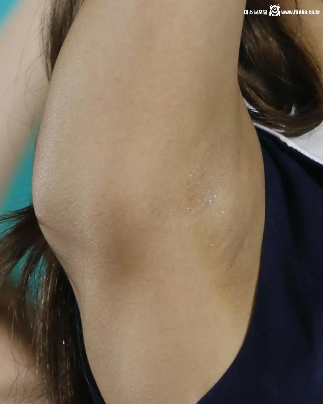 우주소녀 여름 확대 겨드랑이_118042_2.jpg