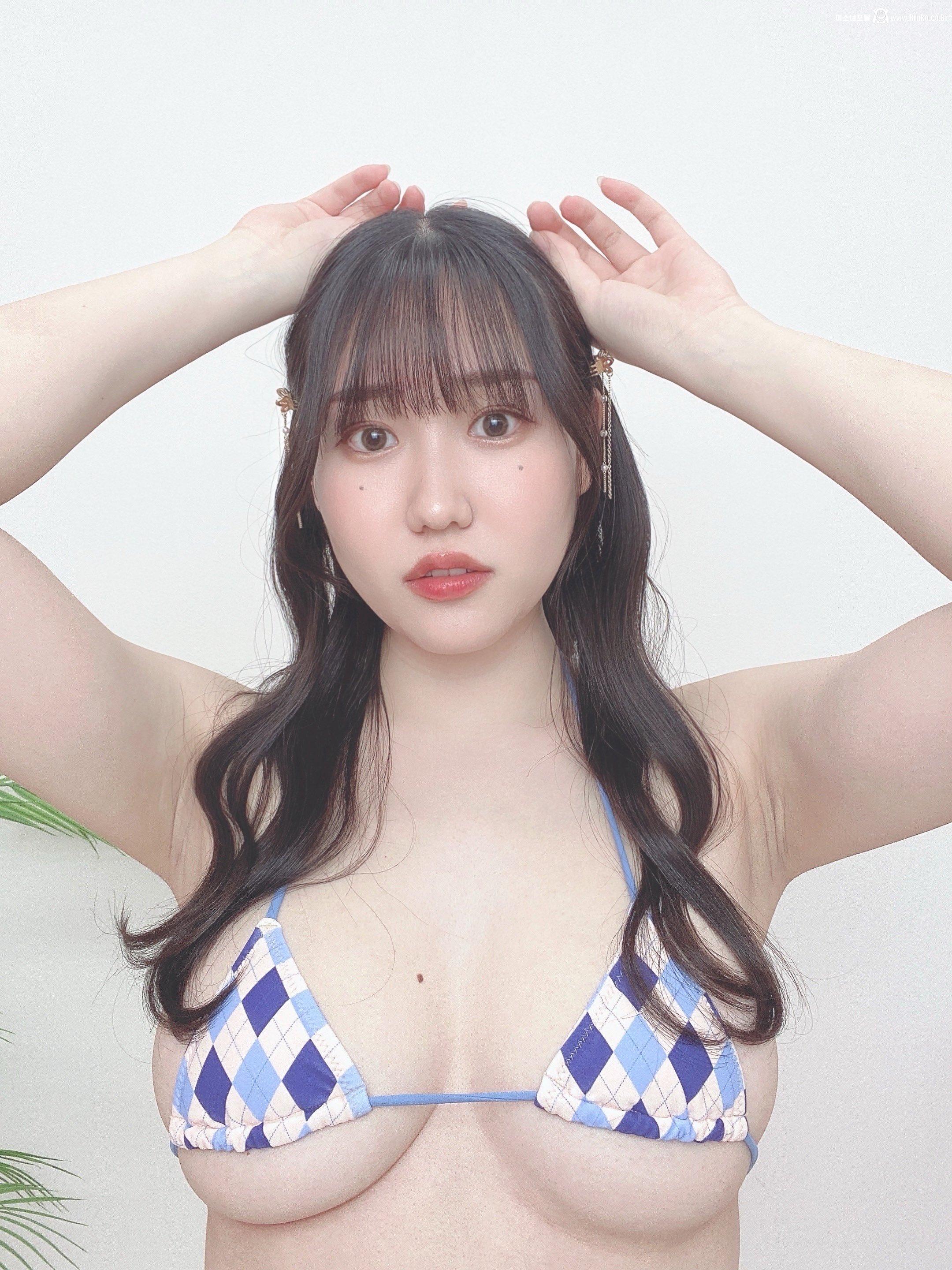 겨드랑이 착색주름2_118876_3.jpg