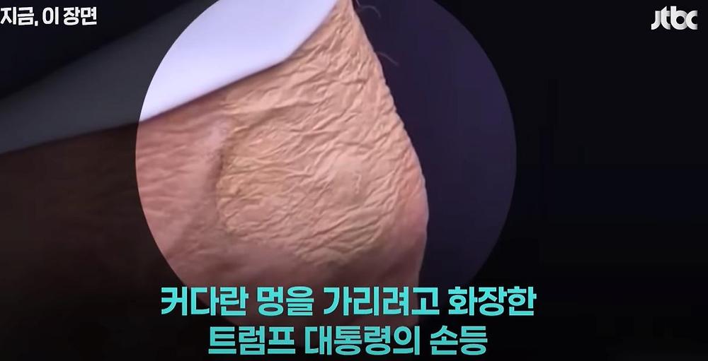 트럼프 대통령 몸 상태1.jpg