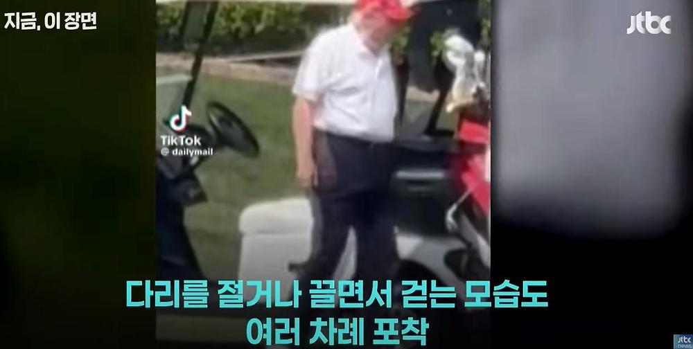 트럼프 대통령 몸 상태2.jpg