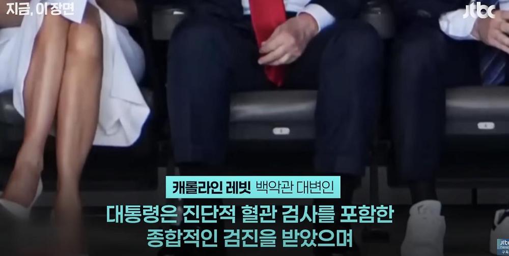 트럼프 대통령 몸 상태4.jpg