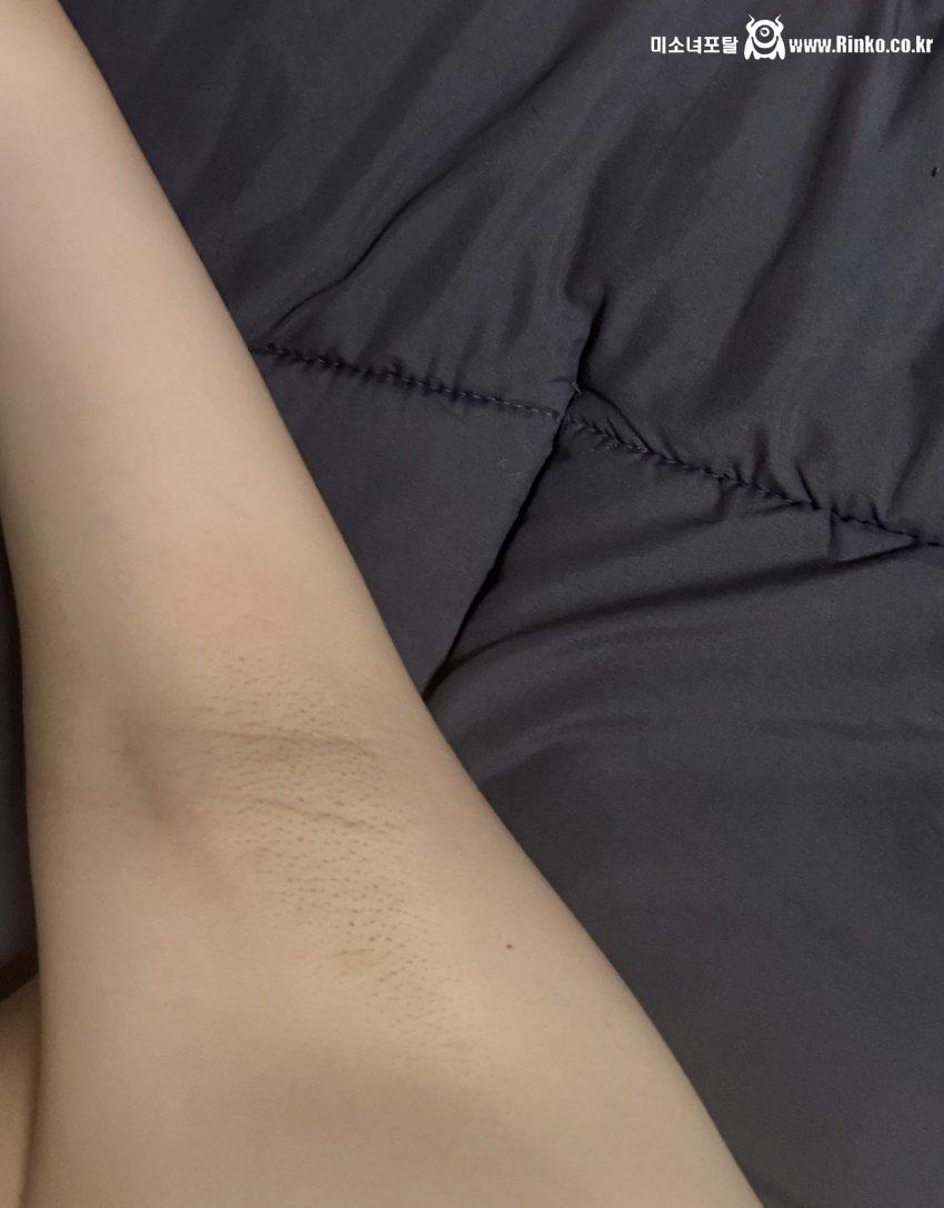 혐주의)여자 겨드랑이좀 봐주세요 어떤편인지_119404_2.jpeg