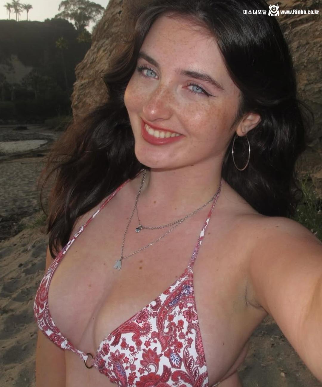 주근깨 백인년_119463_2.jpg