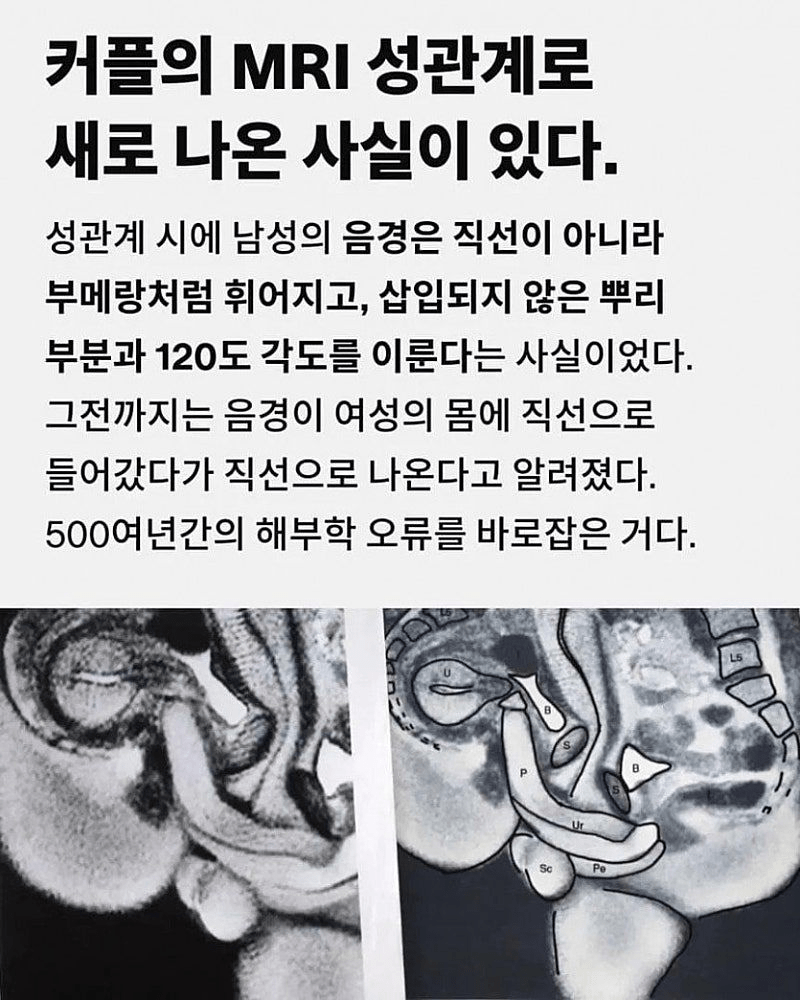 ㅇㅎ) MRI로 밝혀진 놀라운 섹스 사실