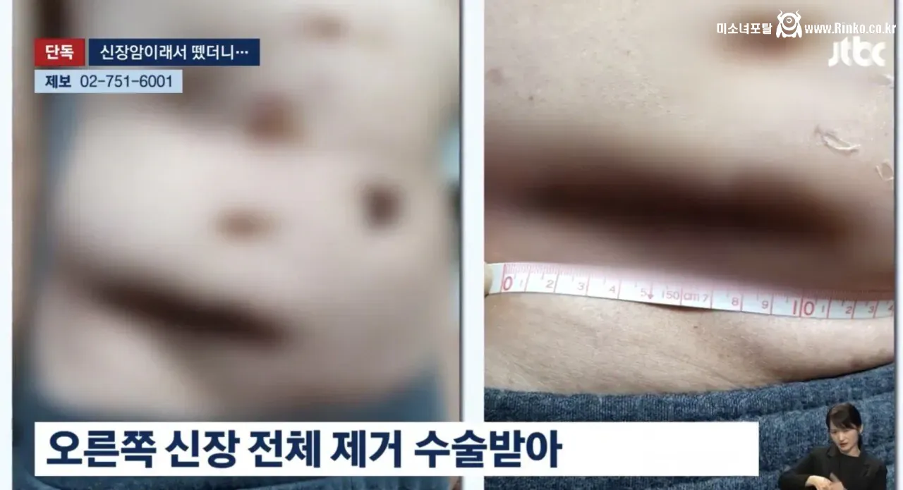 어제 커뮤에서 개난리난 역대급 사건
