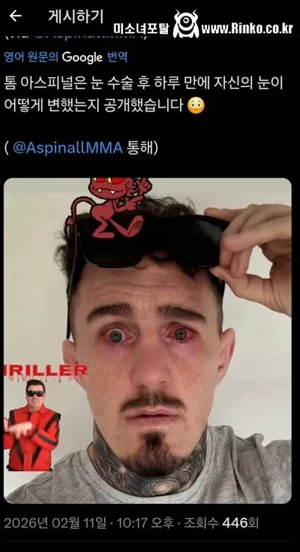 UFC 헤비급 챔피언 톰 아스피날의 수술 사기극