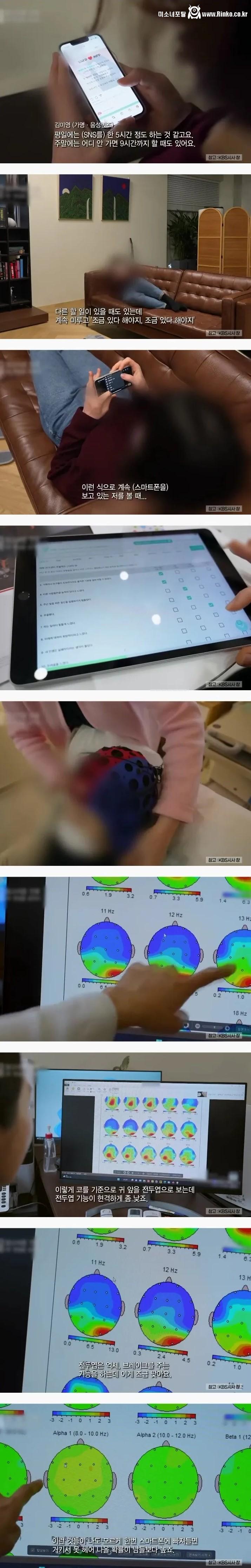 SNS에 빠져 사는 여자의 충격적인 뇌 상태