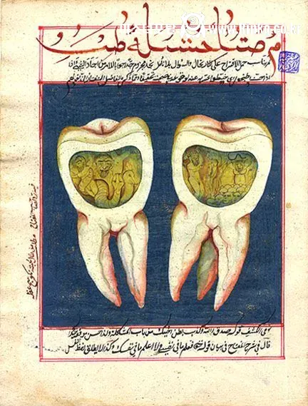 충치를 표현한 오스만 제국 시절 그림