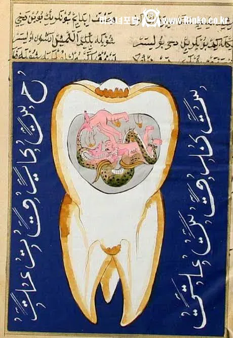 충치를 표현한 오스만 제국 시절 그림