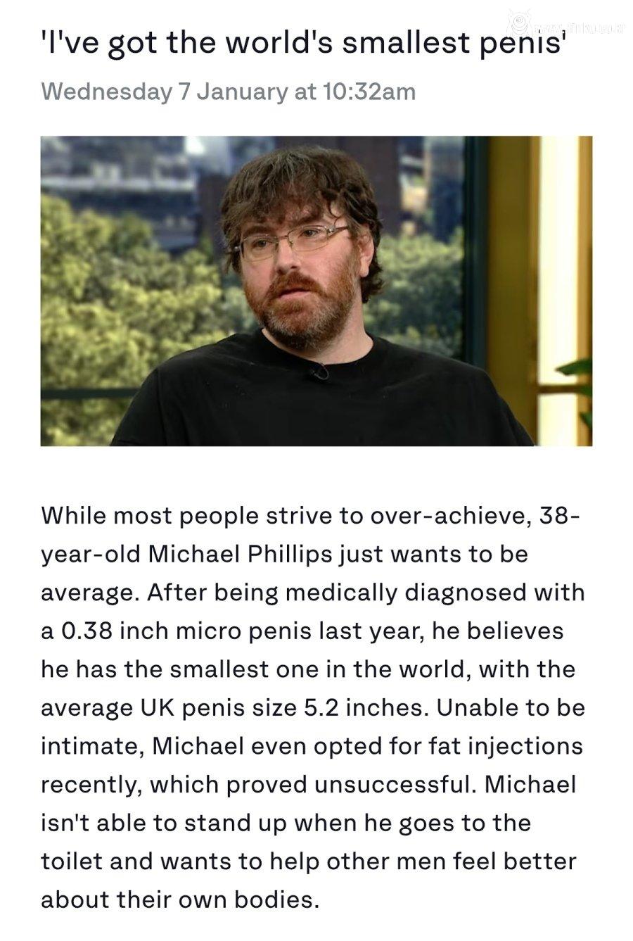 세상에서 가장 작은 성기를 가졌다는 남자