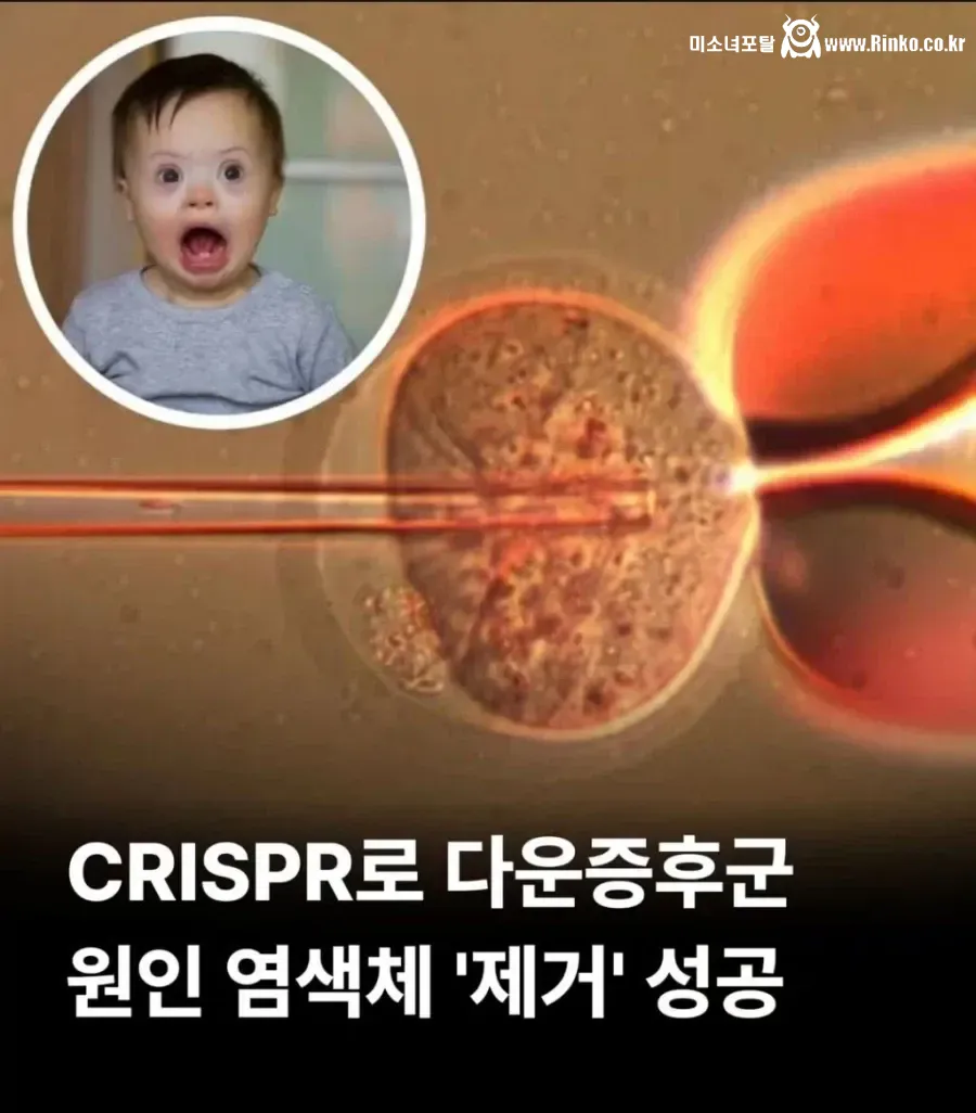 다운증후군 21번 염색체 제거 성공