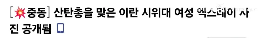 산탄총을 맞은 이란 시위대 여성의 엑스레이 사진 공개