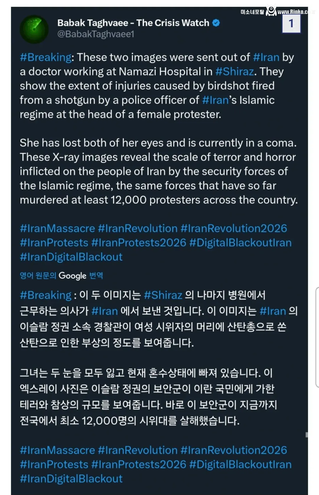 산탄총을 맞은 이란 시위대 여성의 엑스레이 사진 공개