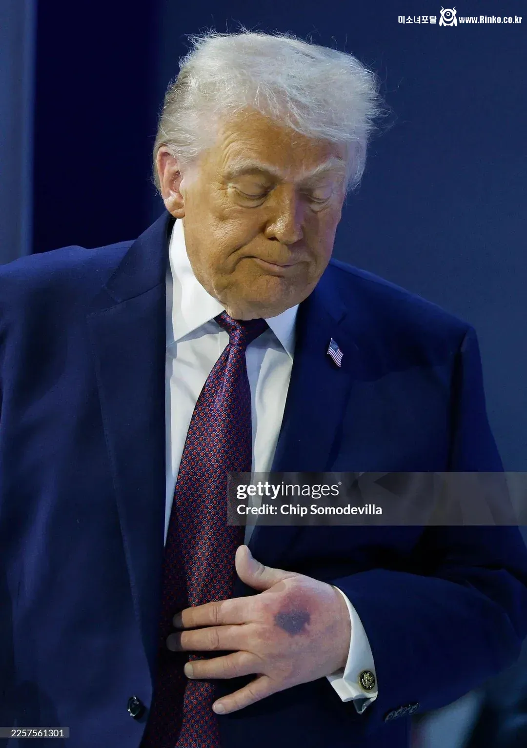 손등에 심각한 멍이 들어있는 오늘자 트럼프