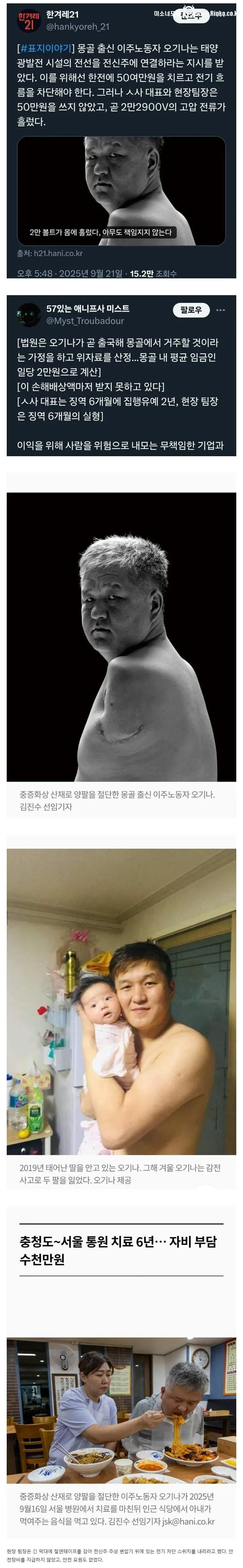 50만원 때문에 양팔을 잃은 몽골 출신 노동자