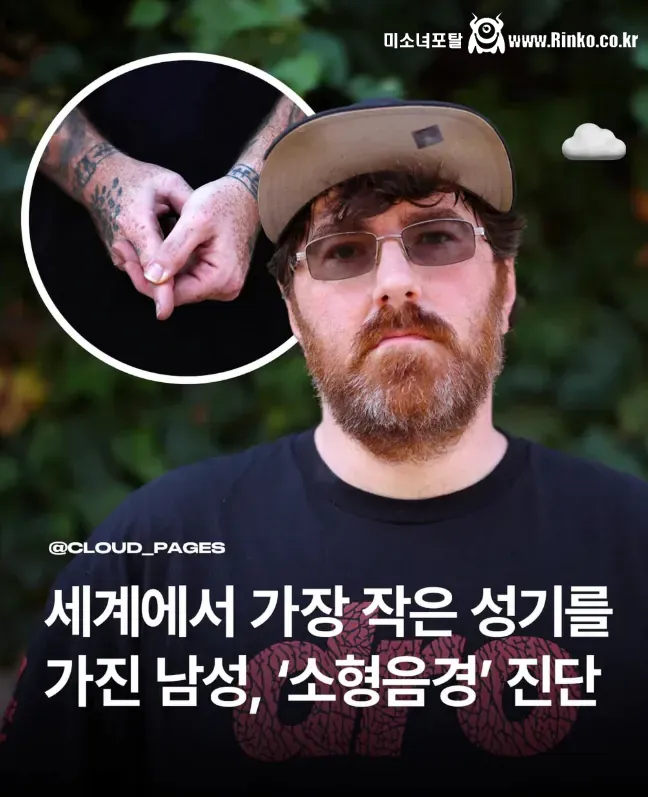 세계에서 가장 작은 성기를 가진 남성 사연