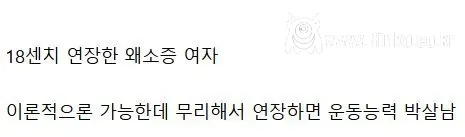 (약혐) 키 13cm 연장한 사람