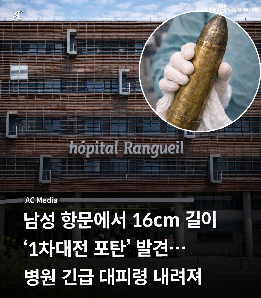 항문에서 발견된 포탄 실제 모습