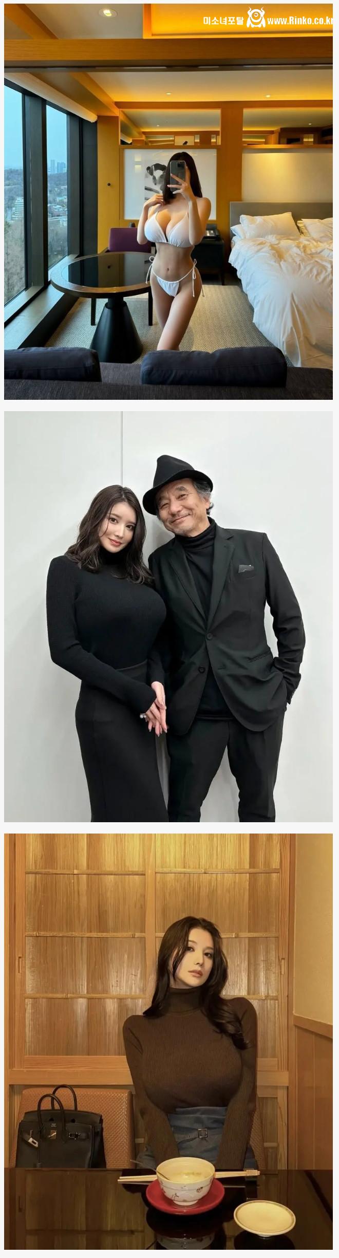 가슴 축소 수술 전후 변화와 효과, 성형 수술 과정 이해 2