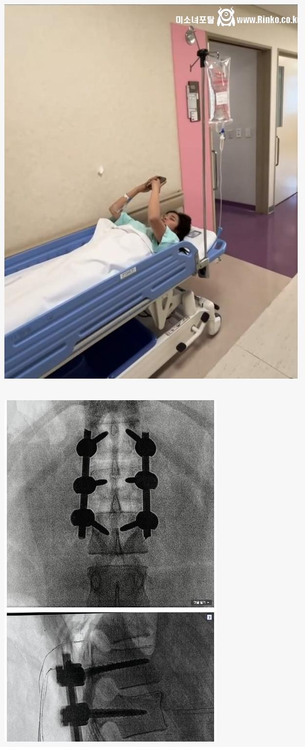 스노보드 최가온 허리 수술 3번.. 끔찍하네요 1
