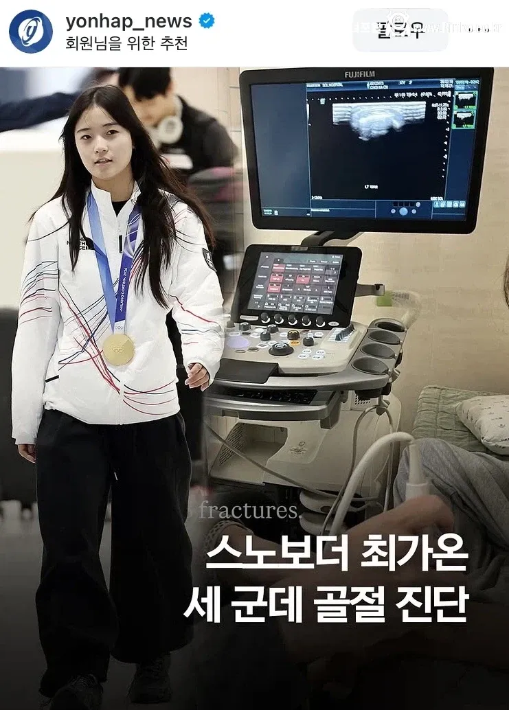 국내 귀국한 최가온 몸 상태 1